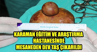 KMÜ Tıp Fakültesi Karaman Eğitim ve Araştırma Hastanesi'nde Hastanın mesanesinden 1050 GR Taş çıkarıldı