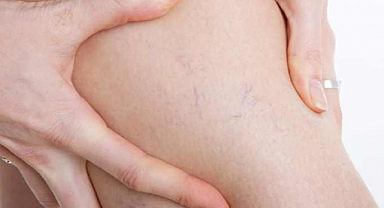 Toplardamar Tıkanıkları İçin Tedavi Yapan Doktorlar