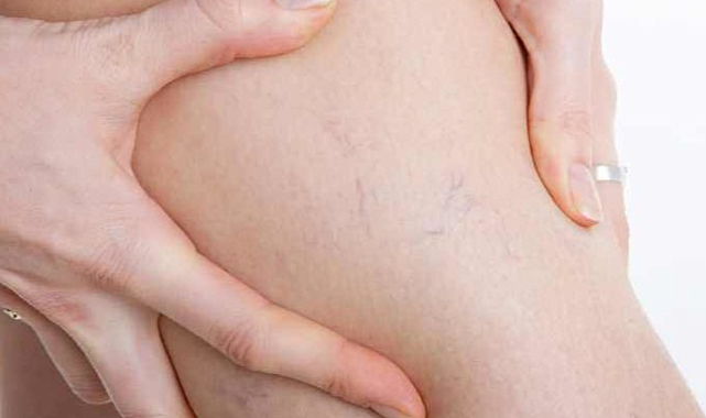 Toplardamar Tıkanıkları İçin Tedavi Yapan Doktorlar