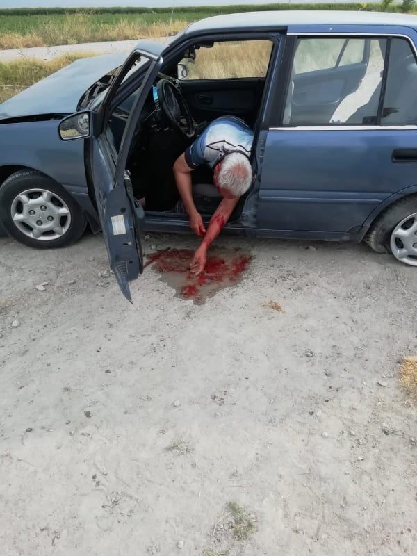 Otomobil Yüksek gerilim direğine çarptı: 1 yaralı